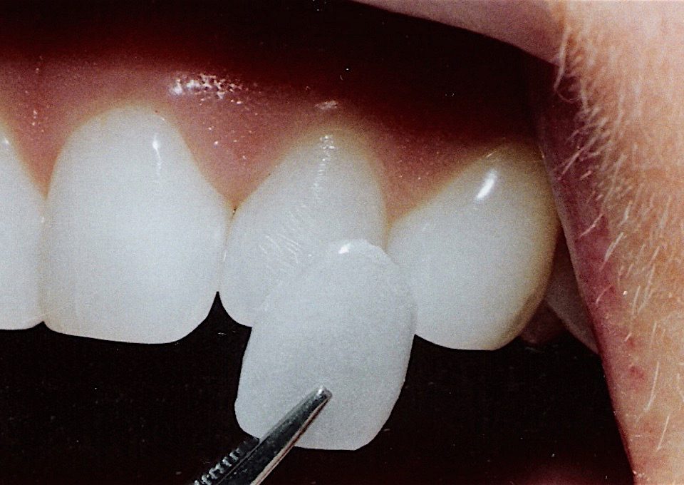 Schellenberg_Dentistry_148